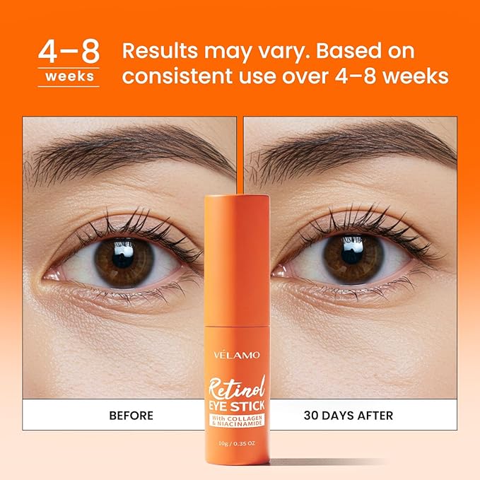 VELAMO ADVANCED Retinol Eye Balm Stick: Under Eye Cream for Dark Circles Puffiness Eye Bags Wrinkles Fine Lines - Korean Skincare Formula with Collagen, Niacinamide, Peptides & Hyaluronic Acid 2 Packs-Velvo Beauty
