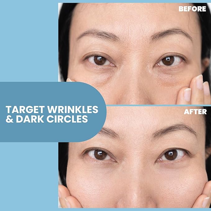 Anti-Aging Eye Gel - Luxurious Hydrating Under Eye Cream For Dark Circles and Puffiness, Bags, Crows Feet, Wrinkles - With Hyaluronic Acid & Skin-Firming Peptides Serum 2 oz (2 Pack)-Velvo Beauty