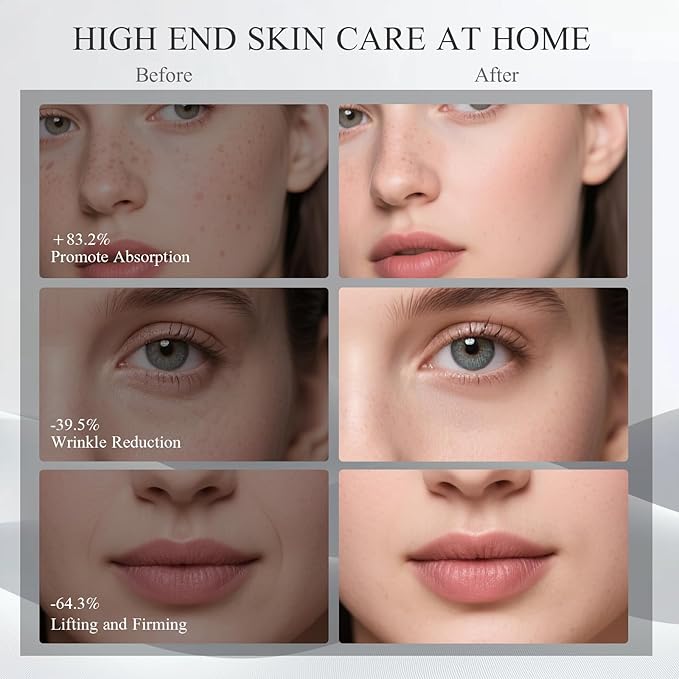 Microcurrent Facial Device, BNU 3-in-1 Light Therapy Beauty Massager for Wrinkle, Lifting, Firming, Puffiness Reduction and Promote Absorption, 4 Level Skin Tightening Machine for Face, Neck and Eye-Velvo Beauty