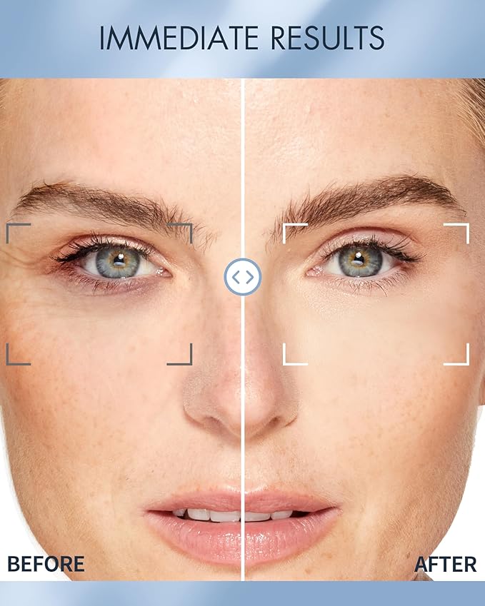 depology Replenish & Repair Under Eye Patches for Puffy Eyes, Wrinkles (60 Patches) | Hydrating with Ceramides and Hyaluronic Acid for All Skin Types | Botanical Extracts Eye Gel Pads 2.96 fl oz-Velvo Beauty