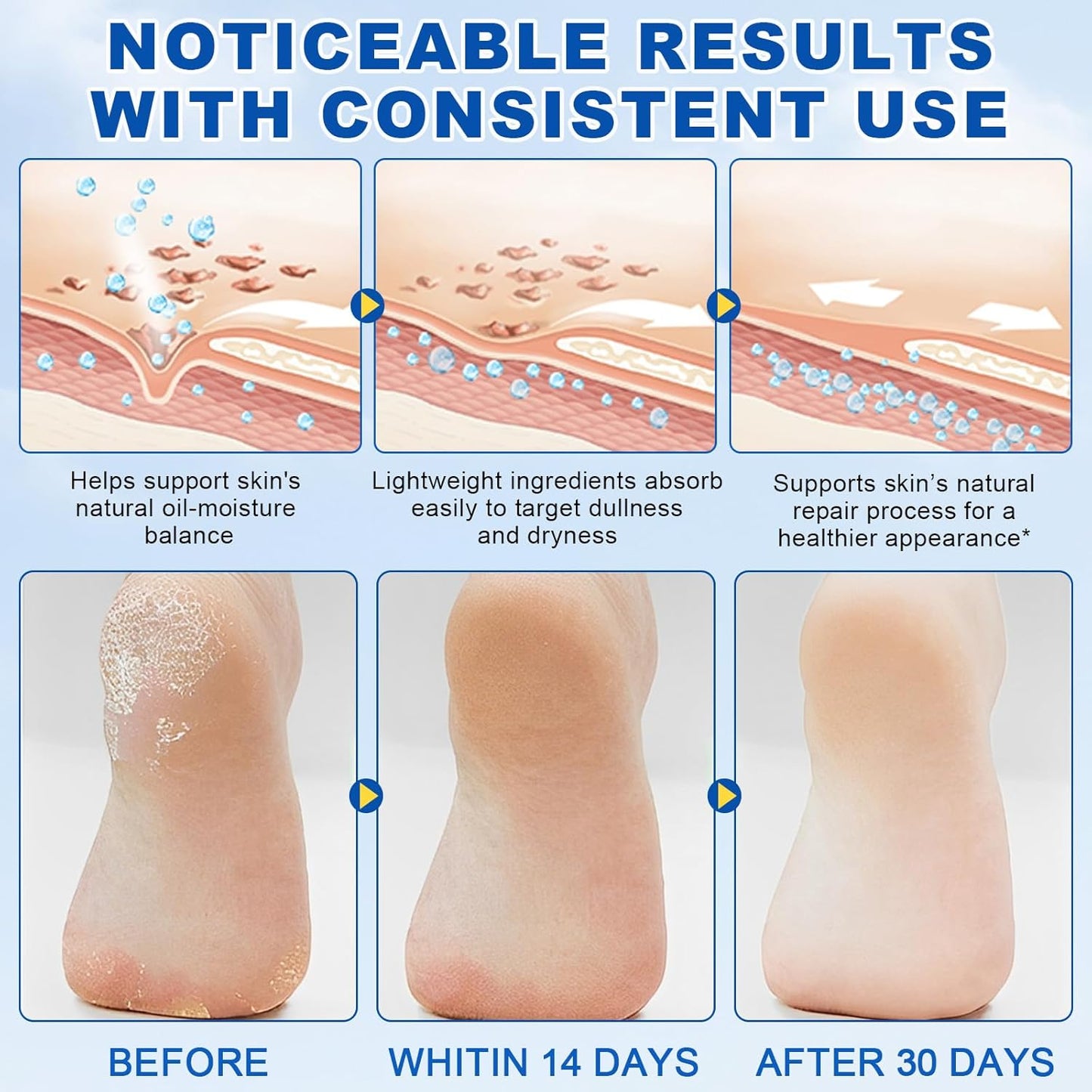 60% Urea with 2% Salicylic Acid Urea Foot Care Stick, Foot Cream Moisturizer for Dry Cracked Feet, Knees, Elbows, Hands,Moisturizes and Hydrates the Dry Skin,Callus Remover & Skin Softener -1.41oz-Velvo Beauty