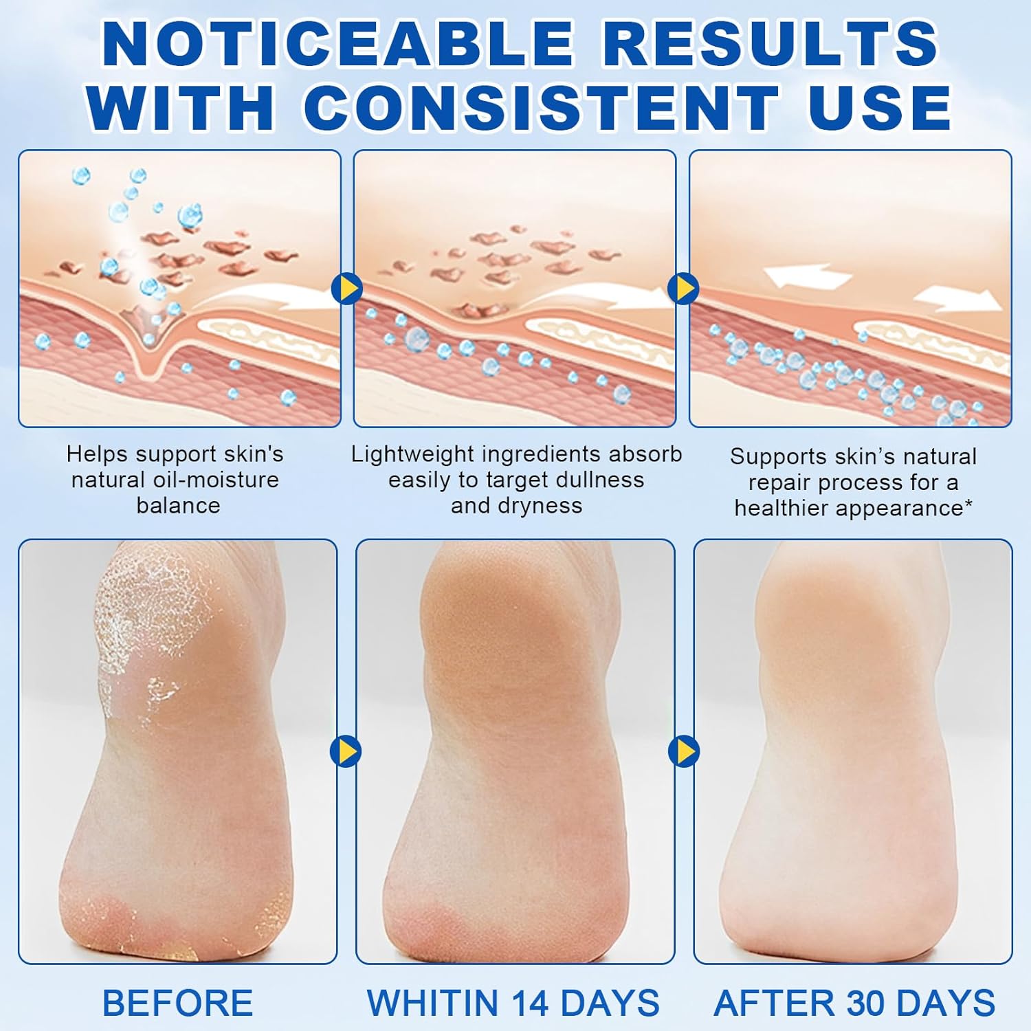 2Pack 60% Urea with 2% Salicylic Acid Urea Foot Care Stick, Foot Cream Moisturizer for Dry Cracked Feet, Knees, Elbows, Hands,Moisturizes and Hydrates the Dry Skin,Callus Remover & Skin Softener-Velvo Beauty