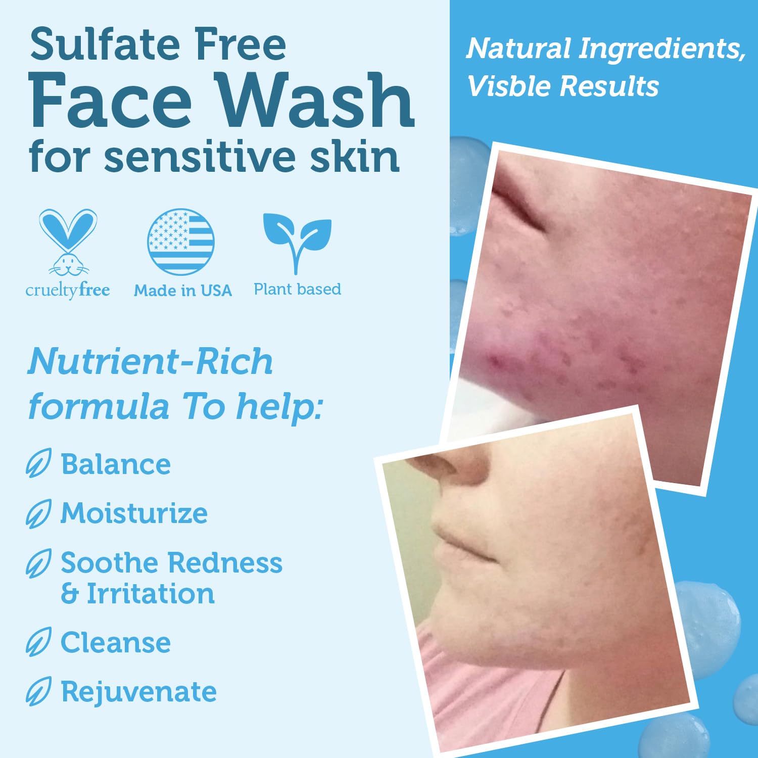 Manuka Honey Face Wash for Women and Men - Sulfate Free Moisturizing Cleanser with Organic Aloe Vera - Soothing Plus Gentle on Dry Skin Facial Cleanser Made in USA - 4oz-Velvo Beauty