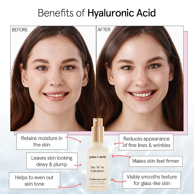 grace & stella Award Winning Hyaluronic Acid Face Serum (50ml/1.7 fl oz) Removes Fine Lines & Wrinkles, Hydrating Hyaluronic Acid Serum for Face, Acido Hialuronico for Women - Vegan Skincare (2-Pack)-Velvo Beauty