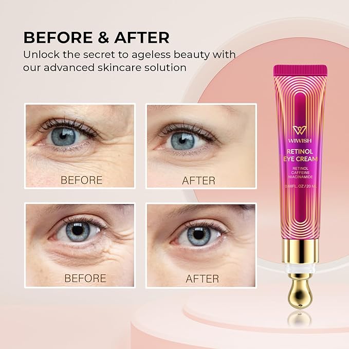Advanced Retinol Eye Cream: Under Eye Cream for Dark Circles and Puffiness, Anti-Aging Eye Cream for Wrinkle Reduction and Firming, Under Eye Treatment Reduces Fine Lines and under eye bags-Velvo Beauty