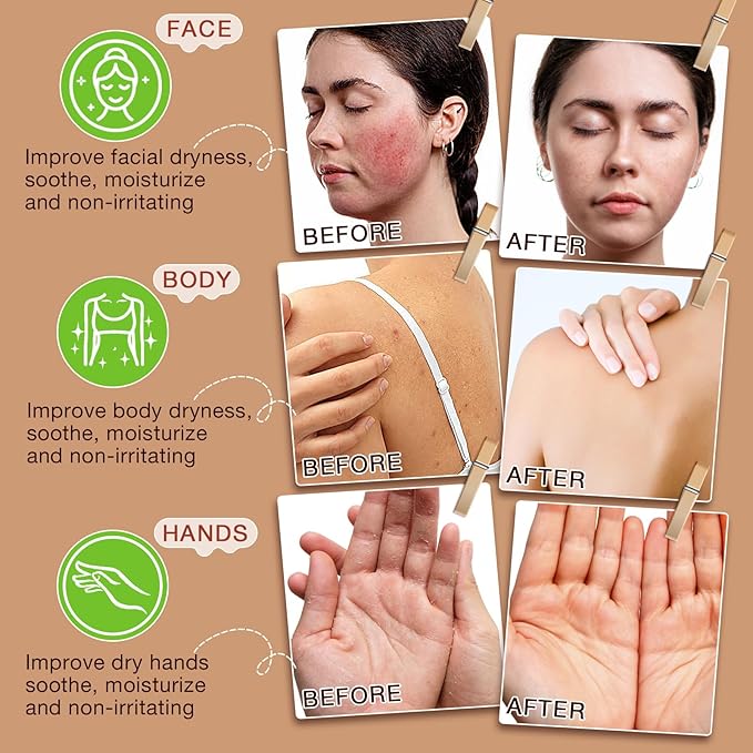 Beef Tallow for Skin,Tallow and Honey Balm,Beef Tallow for Face,Tallow Face Moisturizer,Natural Moisturizer Hydrates,Deeply Nourishes the Skin, Enhances Natural Radiance (1pcs)-Velvo Beauty