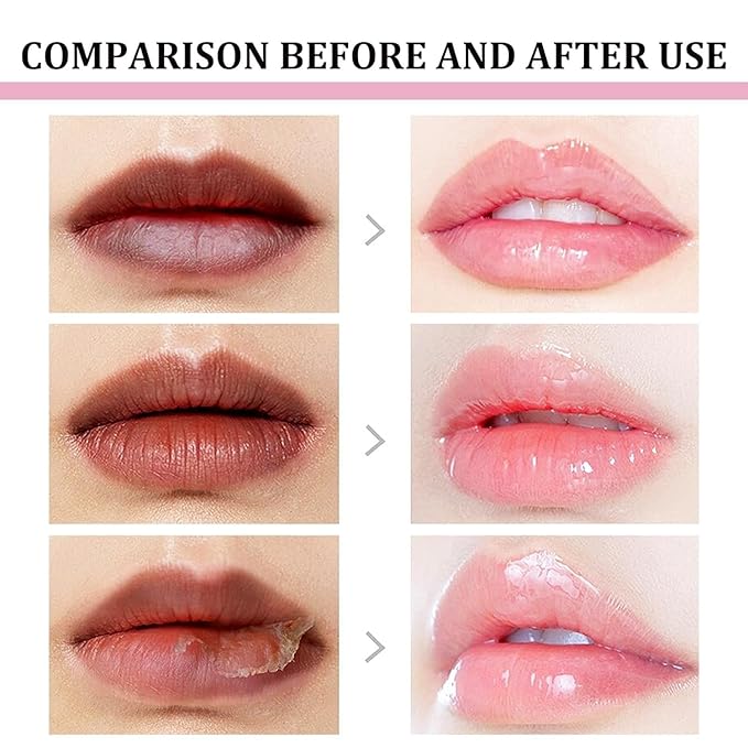 2pcs Lip Lightening for Dark Lips Lip Brightener for Smokers Dark Lip Treatment Lightening Cream for Pink Lips Lip Lightener for Smoker Lips Lip Lightening balm for Men and Women (Pink)-Velvo Beauty