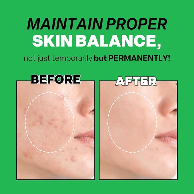 Troubless Mild Clear Toner Essence - Tea Tree Facial Toner for All Skin Types | Hydrating Skin Toner, Daily Skin Care (6.76 fl oz)-Velvo Beauty
