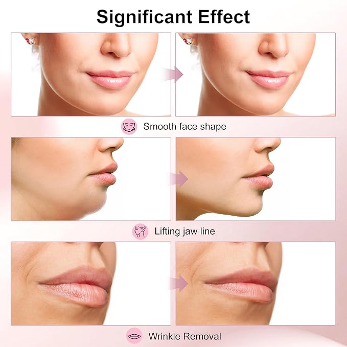 2025 Multi-Functional Face Lifting Device, V Roller Face Lift, Tightening, Skin Care, Double-Sided Roller Design, Type-C Fast Charging, Portable Beauty Device with 3 Adjustable Settings (White)-Velvo Beauty