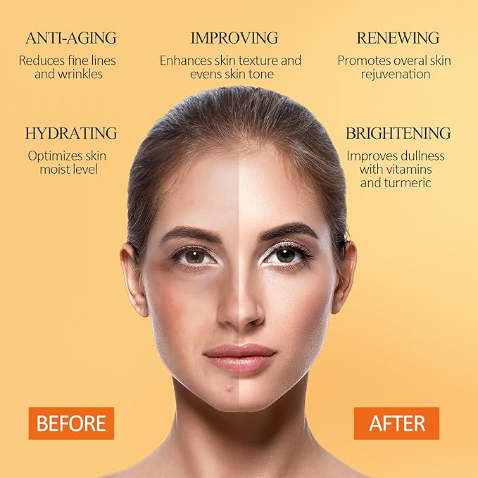 Vitamin C Face Mask with Kaolin Clay and Turmeric for Dark Spots, Dull Skin, Skincare Facial Mask for Controlling Oil and Refining Pores 5.29 Oz-Velvo Beauty