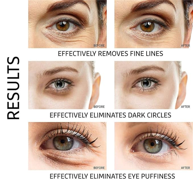 Under Eye Patches - 30 Pairs Collagen Eye Mask Eye Patches for Puffy Eyes and Dark Circles, Gel Under Eye Mask, Black-Velvo Beauty