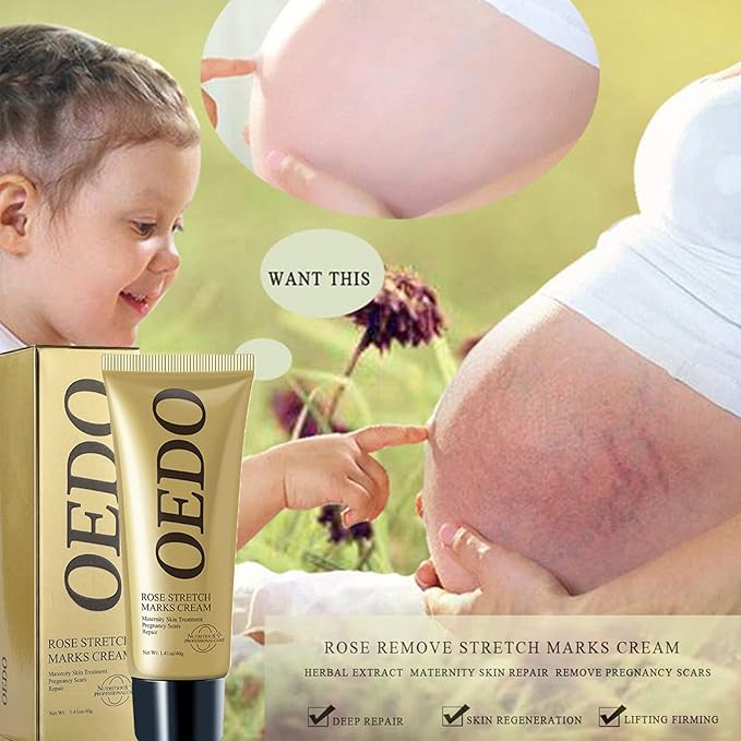 Rose Remove Stretch Marks Cream for Pregnancy Scar Removal Cream Natural Plant Essence Formula Prevention Remove Stretch Mark Old Scars Body Moisturizer 40g-Velvo Beauty