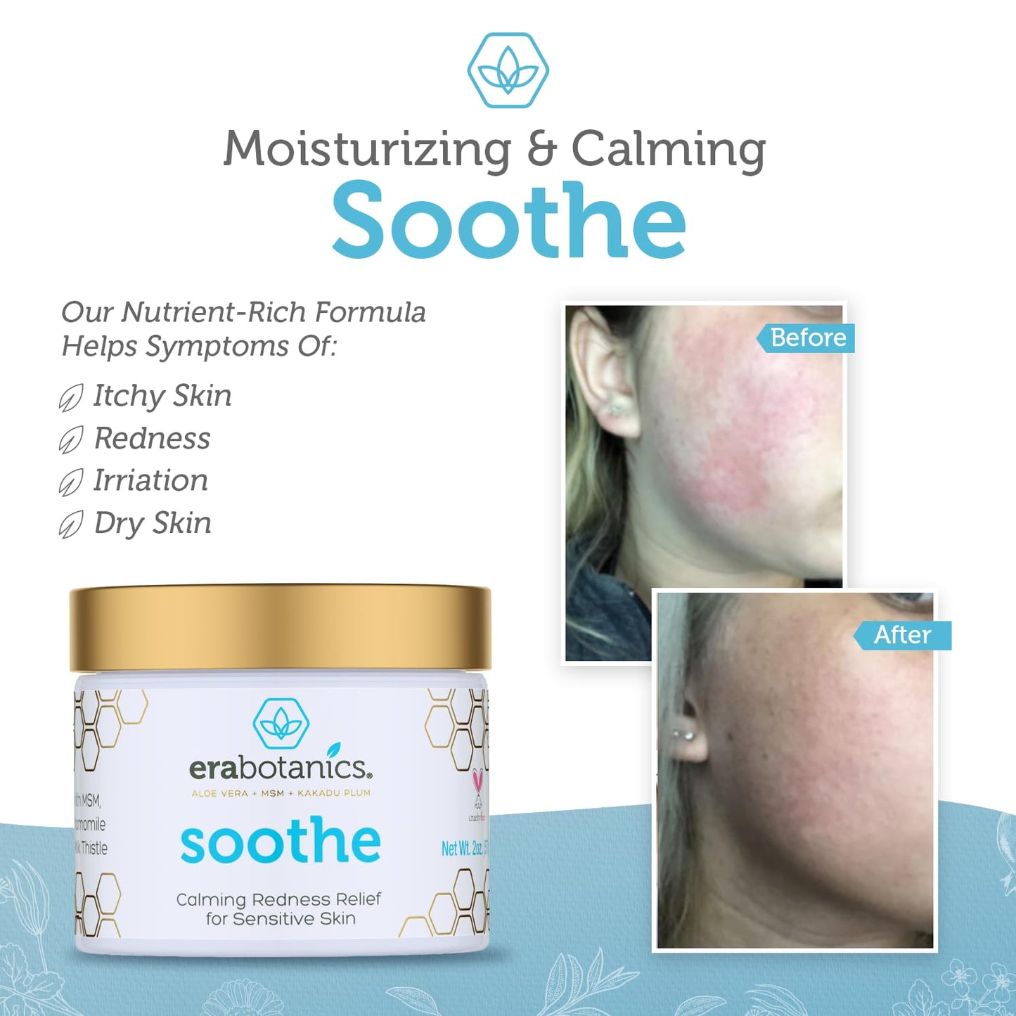 Era Organics Cream Redness Relief Moisturizer- Soothing Redness Relief for Face with Manuka Honey, MSM, Chamomile - Calming Moisturizer Made in USA-Velvo Beauty