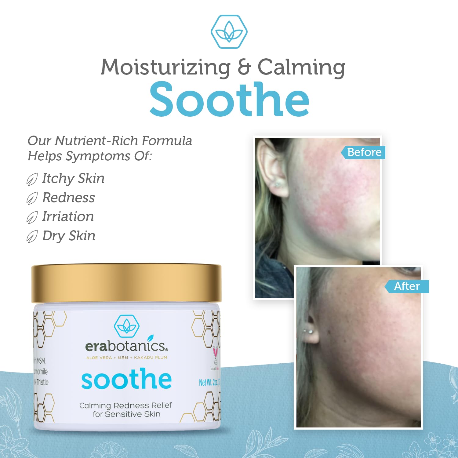 Era Organics Cream Redness Relief Moisturizer- Soothing Redness Relief for Face with Manuka Honey, MSM, Chamomile - Calming Moisturizer Made in USA-Velvo Beauty