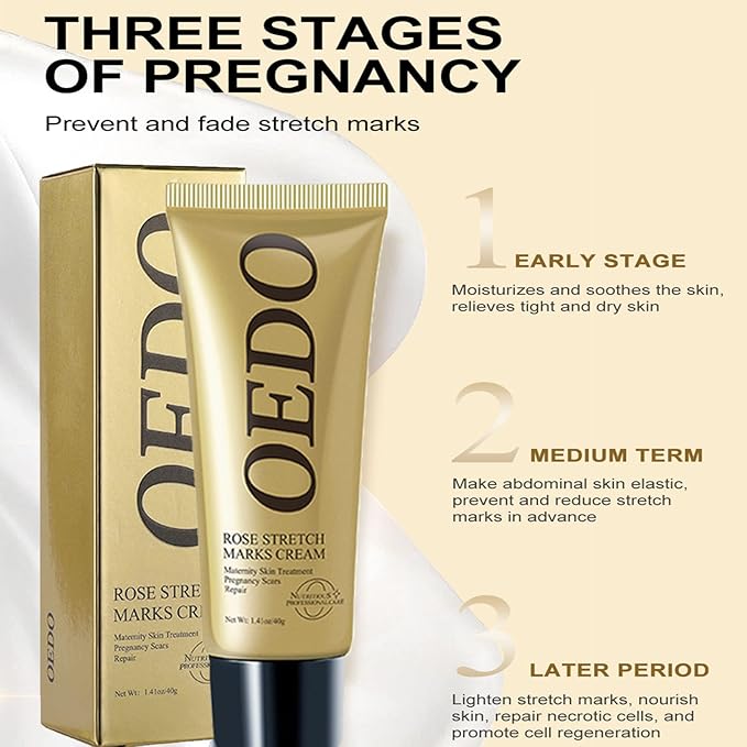 Rose Remove Stretch Marks Cream for Pregnancy Scar Removal Cream Natural Plant Essence Formula Prevention Remove Stretch Mark Old Scars Body Moisturizer 40g-Velvo Beauty