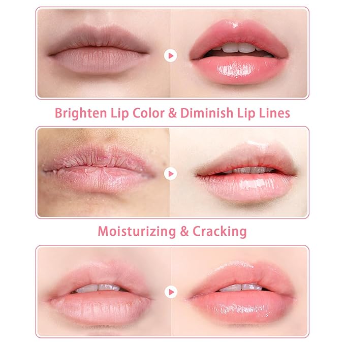 3 PCS Bee Lip Balm Lip Mask Honey Pot, Watermelon & Cherry & Coconut Lip Mask Propolis Moisturizing Lip, Hydrating Prevention Dry and Cracked Lip Scrubs Exfoliator (Watermelon & Cherry & Coconut)-Velvo Beauty