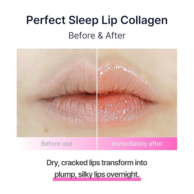 Perfect Sleep Lip Collagen 0.52fl.oz/15ml, Hydrolyzed Collagen+Rice Protein, Willow Bark Extract & Peptide to Nourish, Moisturize & Exfoliate the lips, Sleep-Beauty, Korean Overnight Lip Mask-Velvo Beauty