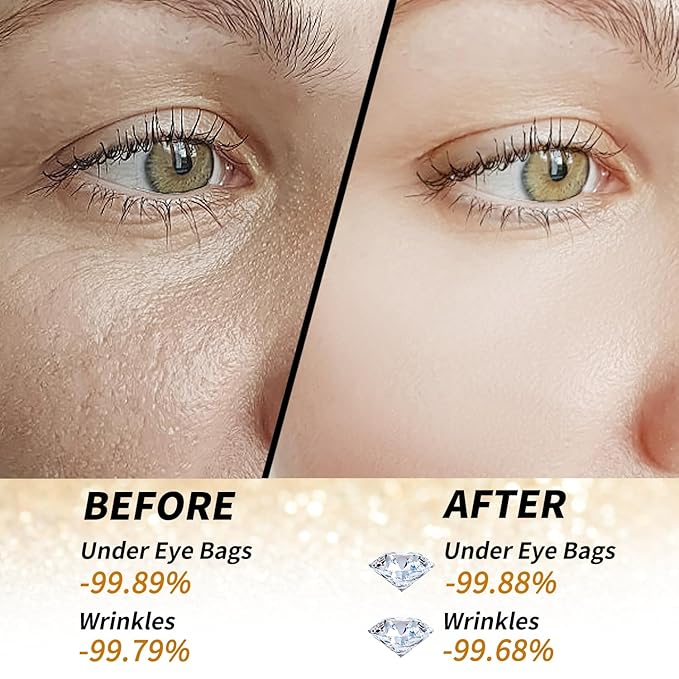 Golden Glow Under Eye Patches for Puffy Eyes - 60Pcs Eye Gels Rejuvenating Treatment for Dark Circles, Puffiness, Refreshing,Revitalizing Looks Less Tired-Velvo Beauty