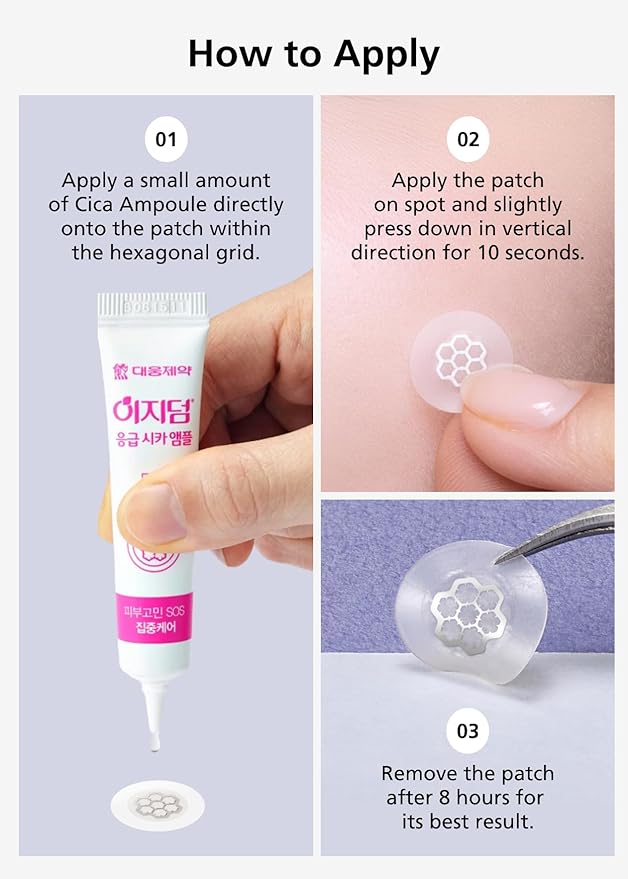 EasyDerm Quick Calming Magnesium Patches – 30 Patches Bulk Pack, Individually Wrapped Acne Care, Includes Tweezers & Ampoule, Korean Skincare, Made by Daewoong Pharmaceutical-Velvo Beauty