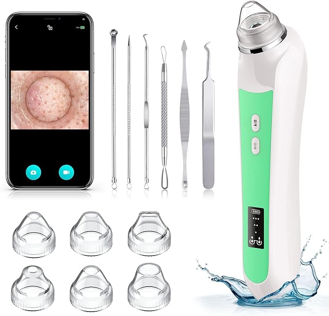 Facial Pore Blackhead Remover Vacuum, 1080P Camera Blackhead Remover, 20x Zoom, 8 LEDs ＆ 3 Suction Modes, 800mAh Battery & USB - 6 Heads Pore Cleaner Kit for Women&Men(Green)-Velvo Beauty