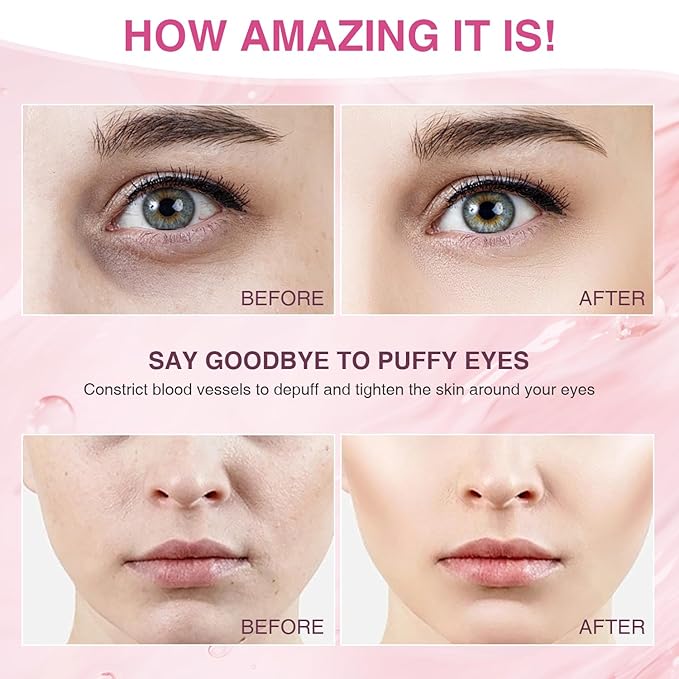 Facial Ice Roller for Skin Care - Aluminum Face Roller to De-Puff, Soothe & Tighten Pores - Cold Therapy Massage Tool for Radiant Glow-Velvo Beauty