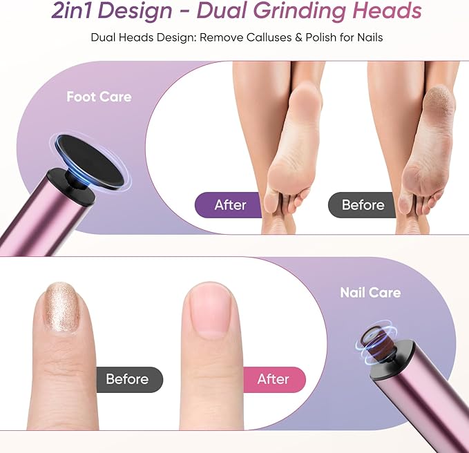 Electric Foot Callus Remover, 2in1 Rechargeable Foot File Callus Remover for Feet, 9 Speeds Foot Scrubber Dead Skin Pedicure Tools for Feet Heel Scraper for Cracked Heels with Sandpaper Discs-Velvo Beauty