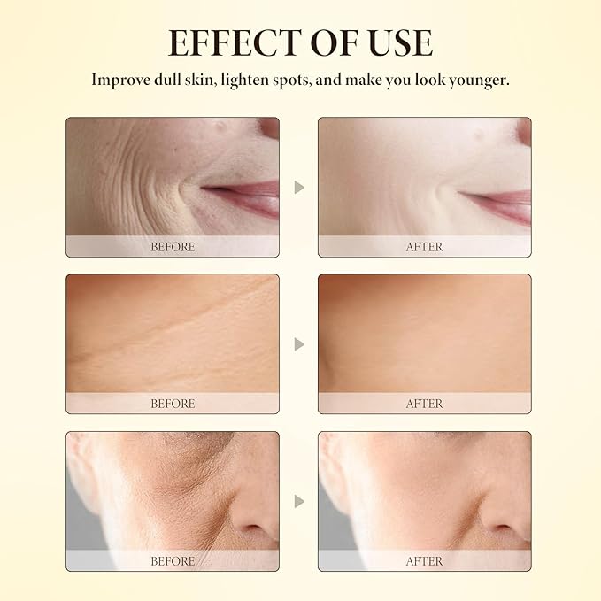 Bee Venom SkinCare Set, Includes New Zealand Bee Venom Face Lotion, Bee Venom Essence, Bee Venom Face Cream, Bee Venom Eye Cream, Anti-Wrinkle, Hydrating & Firming, Plant-Based Formula-Velvo Beauty