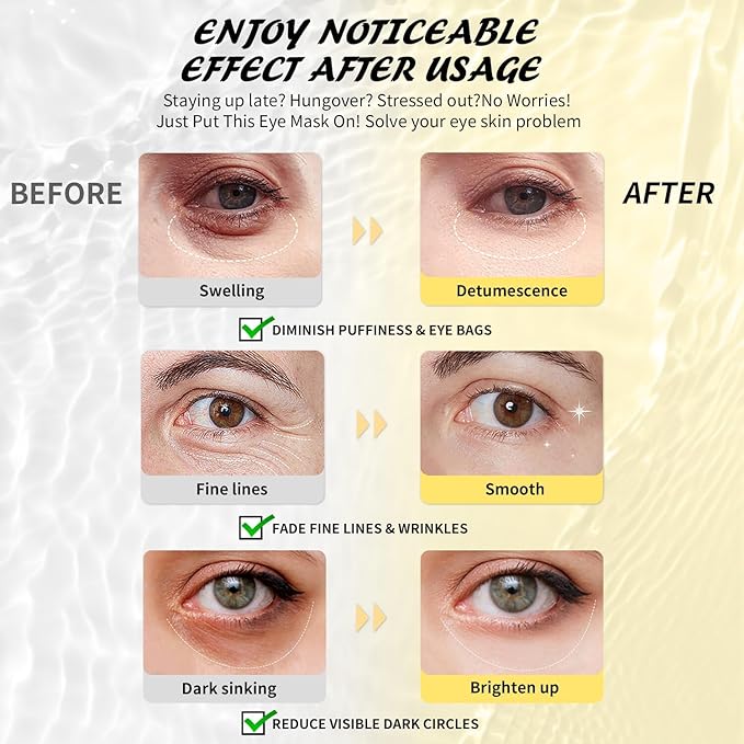 Under Eye Patches(30 Pairs), 24K Gold, Caffeine, Hyaluronic Acid, Aloe Vera Eye Masks for Dark Circles Puffy Eyes Undereye Bags, Eye Skin Care Gift Set for Bachelorette Party Favors-Velvo Beauty