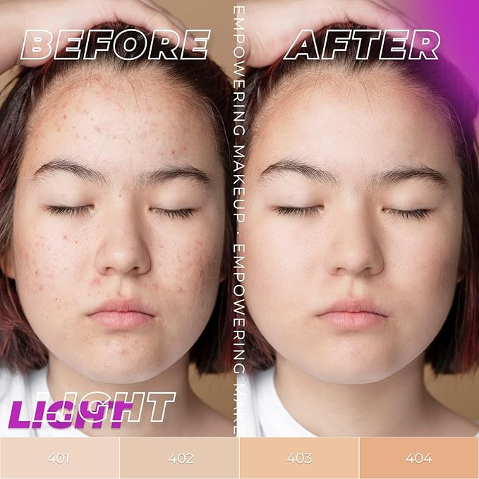 LAMEL OhMy Clear Face Full Coverage Foundation - Acne Coverage - Salicylic Acid & Tea Tree Extract - Dewy & Flawless Finish - Sensitive Skin Care - Organic & Oil-Free - 401, 1.35 fl.oz-Velvo Beauty