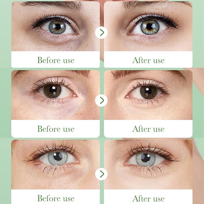 60 Pcs Under Eye Patches, Aloe Vera Eye Masks for Dark Circles & Puffiness with Collagen, Relieve Dryness, Reduce Fine Lines, Soothing Hydrating Under Eye Mask, Skin Care Eye Patches-Velvo Beauty