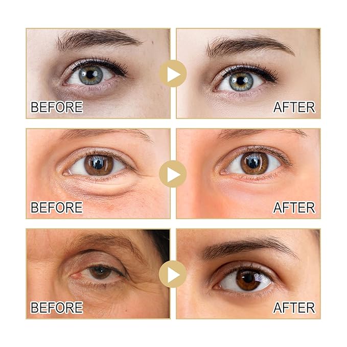 Eye Cream, Collagen Under Eye Cream with Hyaluronic Acid for Dark Circles, Puffy Eyes & Wrinkles, Anti Aging Eye Cream, 1 Fl. Oz-Velvo Beauty