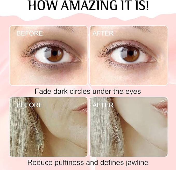 Gua Sha Facial Tools and Face Roller Set, Lymphatic Drainage Massager，Stainless Steel Facial Sculpting Eyes Roller Guasha for Face, Chin & Jawline Sculpting,Skin Care (White)-Velvo Beauty