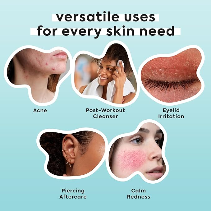 Hypochlorous Acid Spray for Face & Body - Helps Reduce Redness and Breakouts - Travel Size Hypochlorous Spray, Multi-Purpose Topical Facial Skin Repair, pH-Balancing Toner - TSA, Livaclean-Velvo Beauty