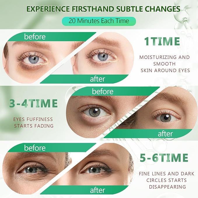 60 Pcs Green Under Eye Patches with 5 Pieces Travel 24K Gold Eye Mask, 30 Pairs Undereye Mask for Dark Circles Puffy Eye Treatment, Collagen Gel Pads Hydrating for Eye Bag Puffiness Wrinkle-Velvo Beauty