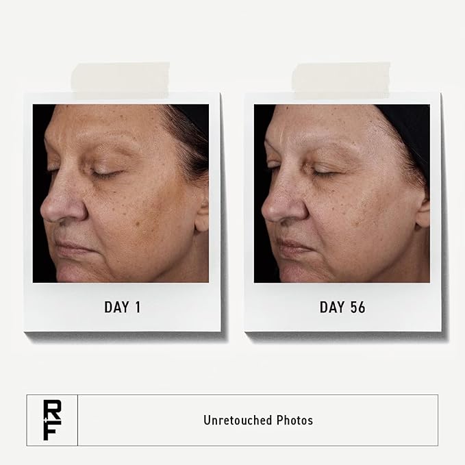 Rodan + Fields Reverse Deep Exfoliating Cleanser | 125 mL | Daily Facial Scrub with Glycolic Acid and AHAs-Velvo Beauty