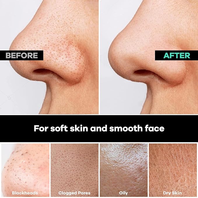 Dermasuri Deep Exfoliating Face Mitt - Scrubber, Dead and Dry Skin Remover for Men and Women - Exfoliator Gloves for Shower and Dry Use - (2 Pack)-Velvo Beauty