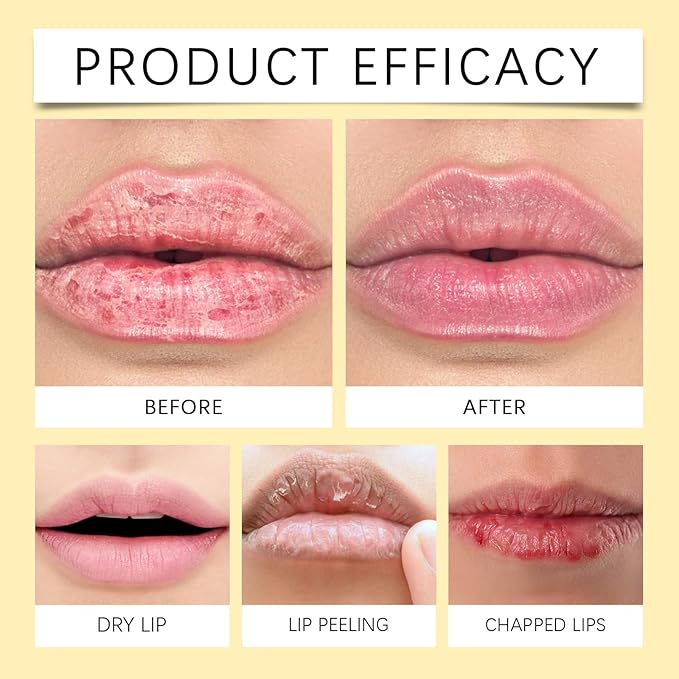 Lemon Lip Balm | All Natural Turmeric Lip Balms & Moisturizers | Hydrates Care Lip Balm, Brighten & Nourish Dark Lips Effortlessly-Velvo Beauty