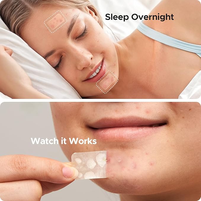 Large Acne Patches for Face, 7 Sizes Big Pimple Patches, XL Hydrocolloid Bandages for Body, Chin, Forehead, Nose, Back Blemish Zit Breakouts, Hydrocolloid Patch (Square, Strip, Dot 142 Count)-Velvo Beauty
