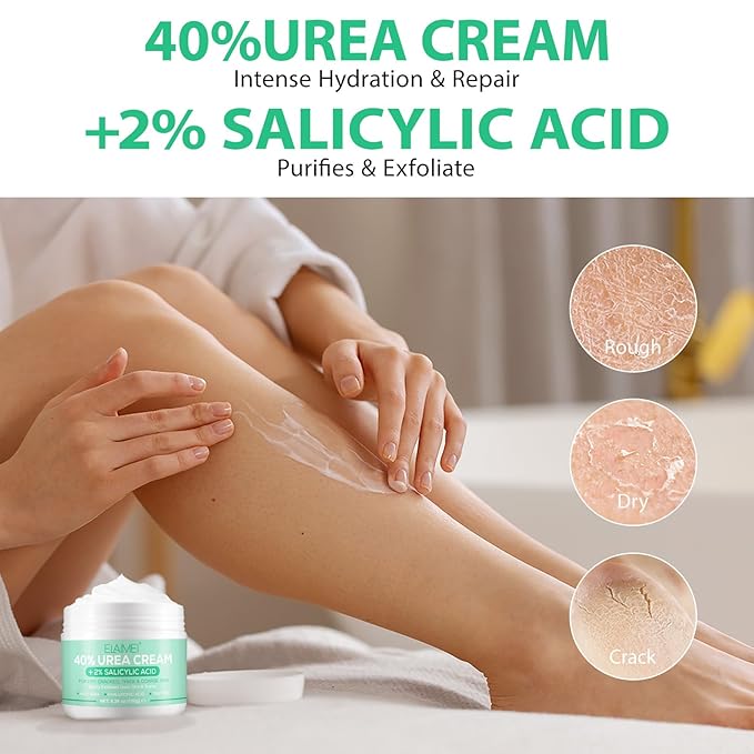 J&H Jasmine&Hyacinth 40% Urea Cream with 2% Salicylic Acid, Aloe, Feet/Heel Cream Moisturizer for Dry Cracked Heel, Knees, Elbows, Hands, Callus Remover, Intensive Hydrating Treatment-5.3 OZ/150 G-Velvo Beauty