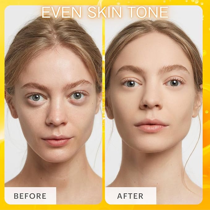 Vitamin C Skincare Set, 5Pcs Skincare Gift Set With Cleanser, Toner, Face Serum, Face Cream, And Eye Cream, Facial Kit for Women, 5-In-1 Skin care Gift Set, Moisturizing Skincare Set For Women Men-Velvo Beauty