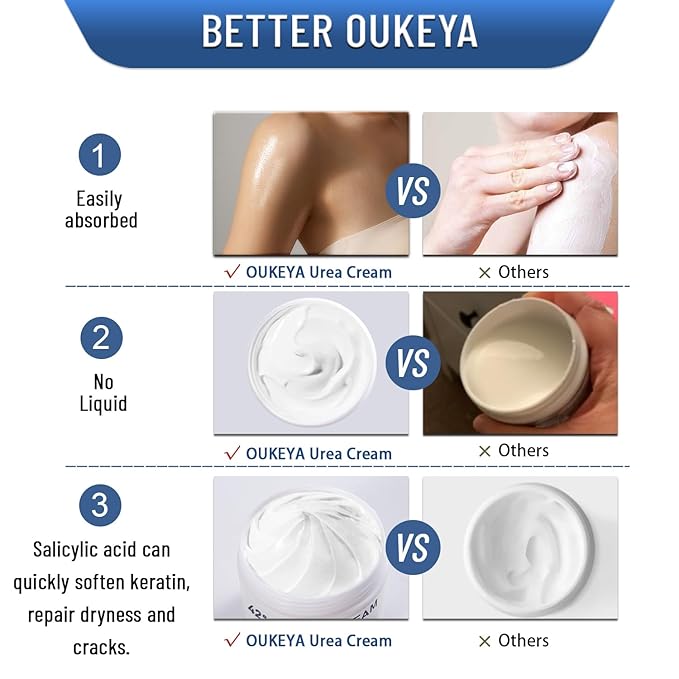 OUKEYA Urea Cream 42% plus Salicylic Acid 2% Net 5.29 Oz for Dry Cracked Feet,Heels,Knees,Elbows,Hands Repair Treatment Moisturizes and Removes Corns,Calluses,Dead Skin,and Softens Toenails-Velvo Beauty