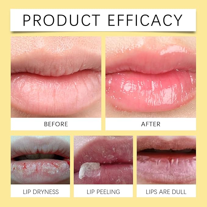 Honey Lip Balm, Propolis Long Lasting Hydrating Lip Butter & Mask, Overnight Nourishing Care, Gentle Exfoliation, Non-sticky Fresh Texture-Velvo Beauty