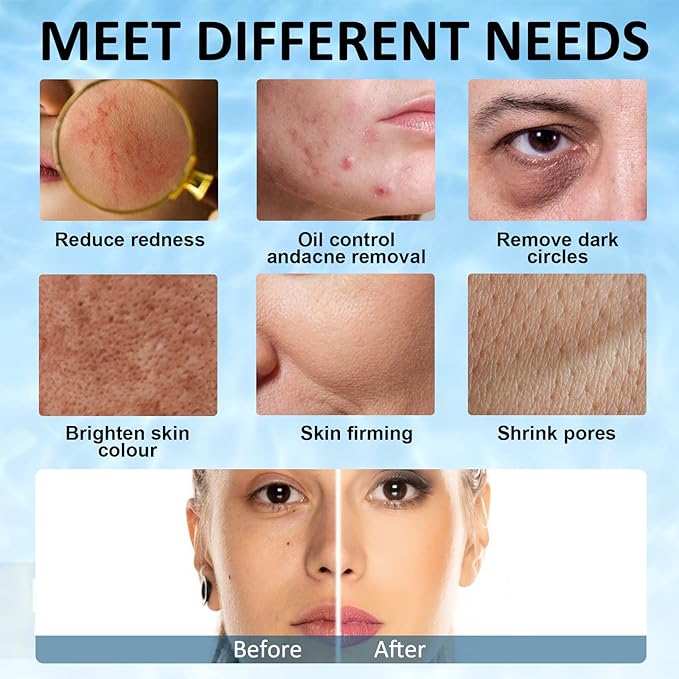 Ice Face Roller, Joyeee Silicone Ice Roller For Face and Eyes Puffiness Relief Reusable Face Ice Cubes Migraine Pain Relief Facial Ice Mold Skincare Tools Gifts for Women Beauty-Velvo Beauty