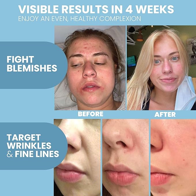 Eva Naturals Retinol Serum for Face – Anti Aging Night Serum with Hyaluronic Acid, Vitamin E, Witch Hazel, Aloe – Wrinkle Moisturizer, Dark Spot Corrector, Acne Scar Treatment, Skin Brightening – 2oz-Velvo Beauty