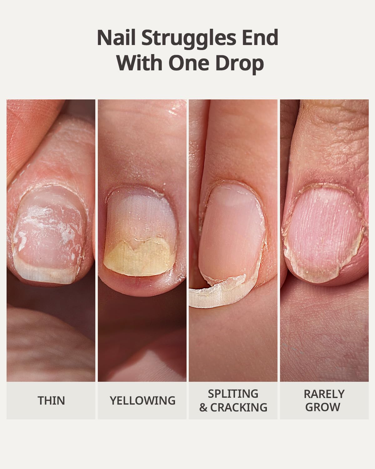 BTARTBOXNAILS Naillush Nail Strengthener & Growth - Repair Damaged Nails, Strengthen Weak & Thin Nails, Extra Strong Nail Growth Treatment, Long Lasting Nail Hardener, 15ml-Velvo Beauty