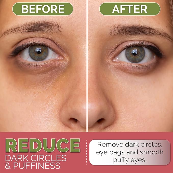 Under Eye Mask for Dark Circles, Puffiness and Eye Bags with Rose (60 Patches), Anti-Wrinkle for Puffy Eyes, Eye Masks with Hyaluronic Acid and Collagen Hydrogel Eye Gel Pads, Premium Korean Skincare-Velvo Beauty