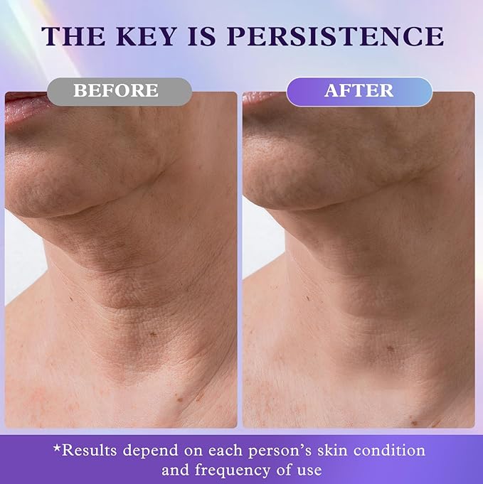 Retinol Neck & Face Wrinkle Cream for Women, Neck Cream for Tightening and Firming, Anti Aging Skin Care with Collagen & Hyaluronic Acid, Instant Face Lift Cream 1.7 Fl Oz-Velvo Beauty