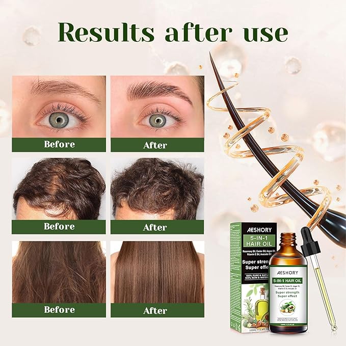 Aeshory Hair Oil - 5 IN 1 Hair Care Oil with Rosemary, Castor, Argan, Vitamin E, and Avocado for Hair Growth and Strengthening - Nourishing and Volumizing 3.38 fl oz-Velvo Beauty