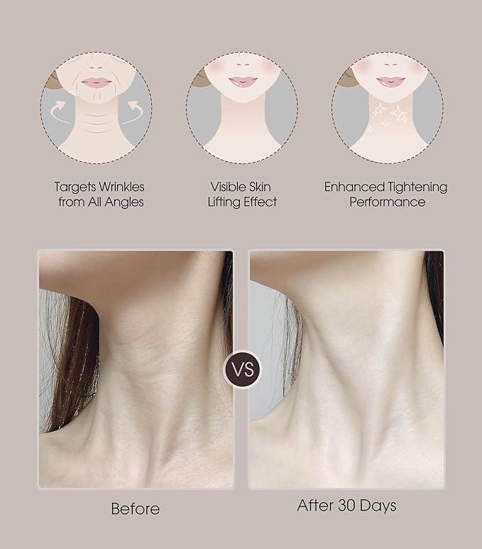 Intelligent Neck Lifting Device, 3 Color LED Neck Massager with Remote Control for Facial Massager | at Home Skin Care Tool-Velvo Beauty