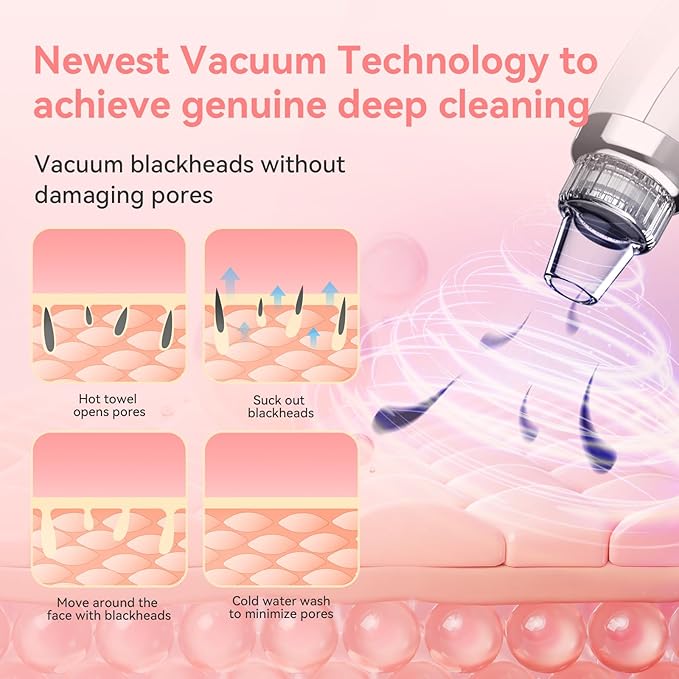 Blackhead Remover Pore Vacuum Upgraded Facial Pore Cleaner Electric Comedone Whitehead Extractor Tool-5 Suction Power,5 Probes,USB Rechargeable Blackhead Vacuum Kit for Women & Men-Velvo Beauty